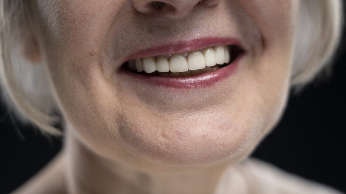 Regeneracion-osea-en-Implantologia-clinica-dental-patricia-dentista-getafe-clinica-dental-getafe (1)