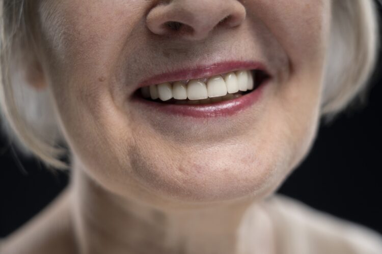 Regeneracion-osea-en-Implantologia-clinica-dental-patricia-dentista-getafe-clinica-dental-getafe (1)